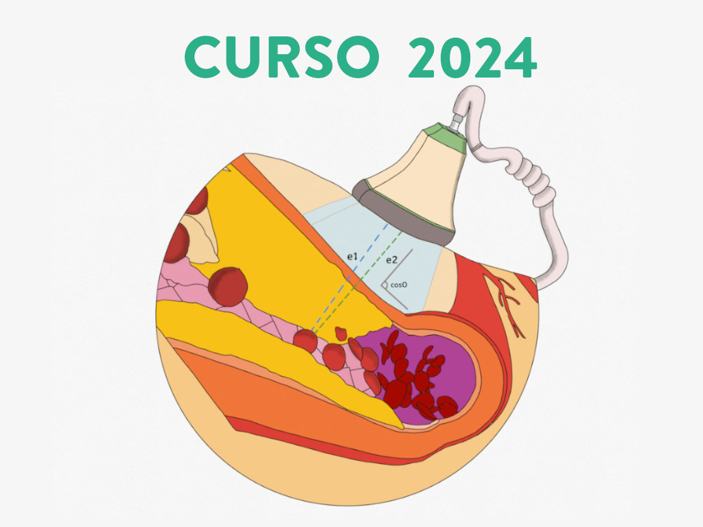 asgcv-curso-fistulas-arteriovenosa-para-hemodialisis-manejo-ecografico-basico-2024-portada-001